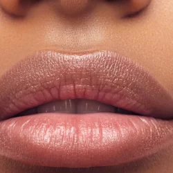 lip injections_black woman-4